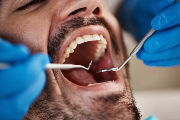 Best Emergency Dental Care for Sports Injuries in Linden, AL